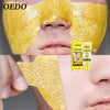 Gold Blackhead Removal Face Mask
